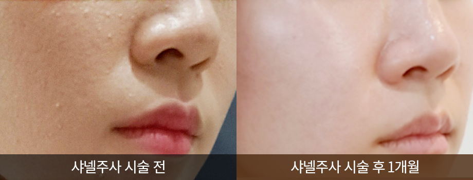 전후사진
